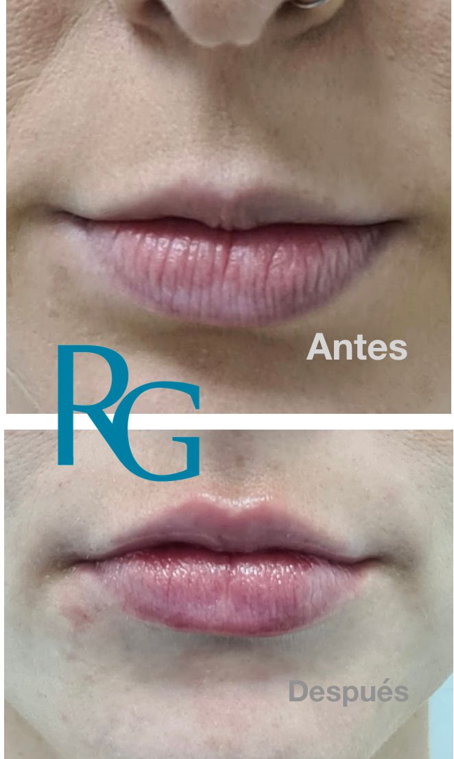 Rafael Gonzalez Oñate-8