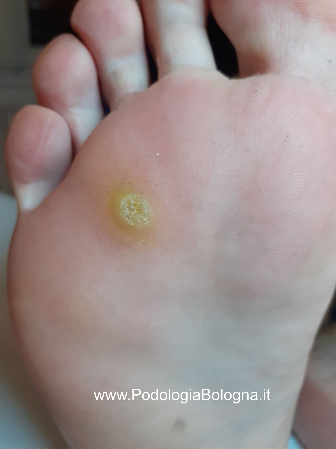 Lorenzo Fasanelli Menestrina-9