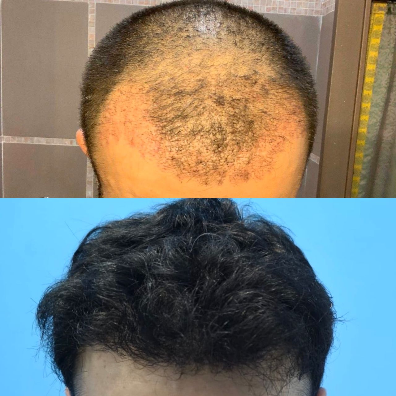 Antonio Napoletano-5