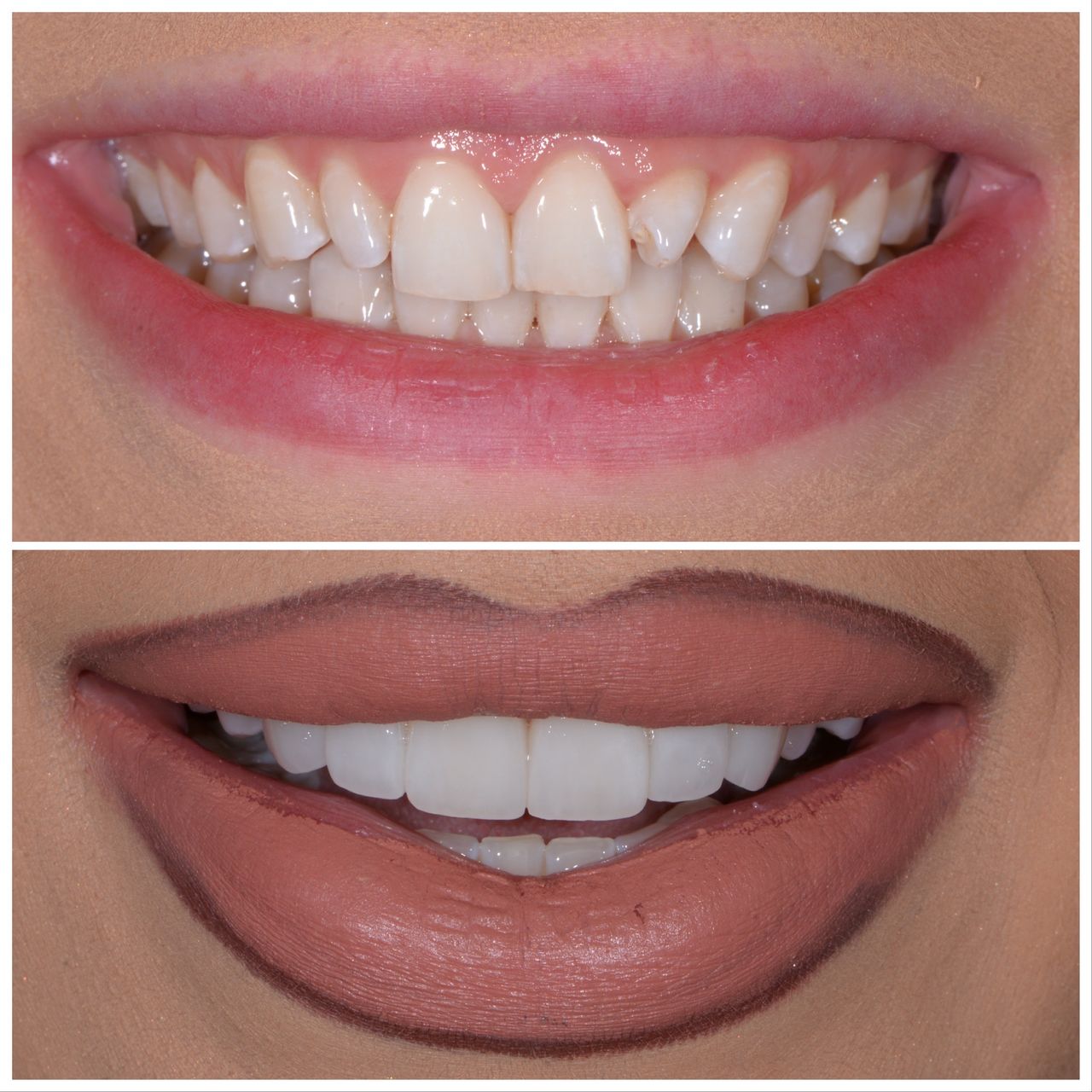 Martin Bartoszcze-25