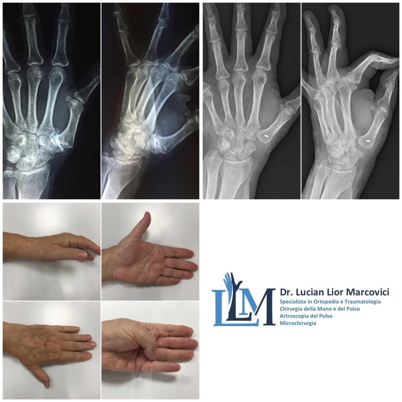 Lucian Lior Marcovici-8