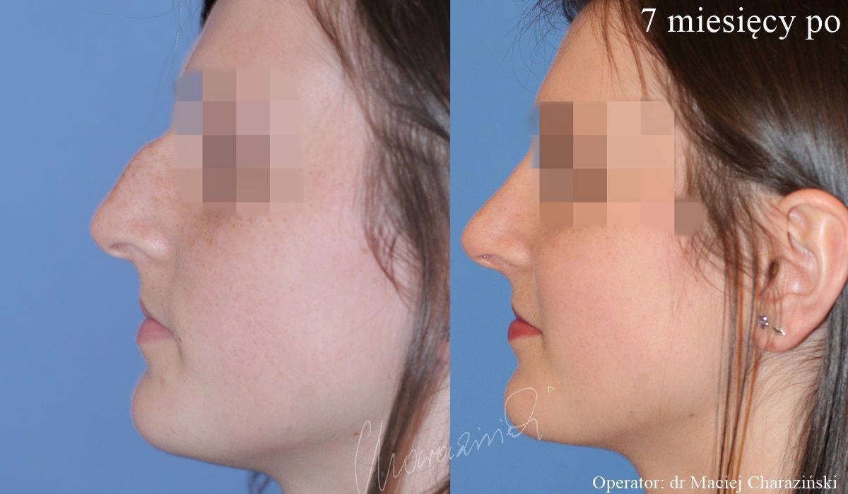 Maciej Charaziński-17