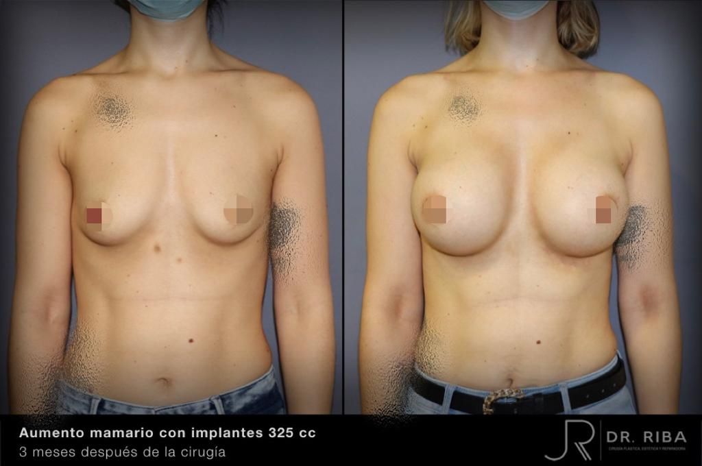 Jordi Riba Vilchez-37