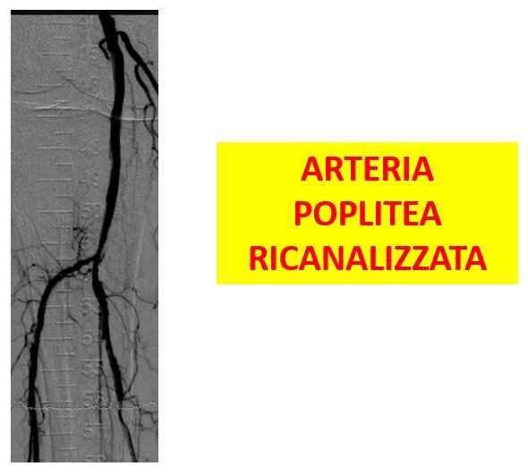 Gianni De Angelis-12