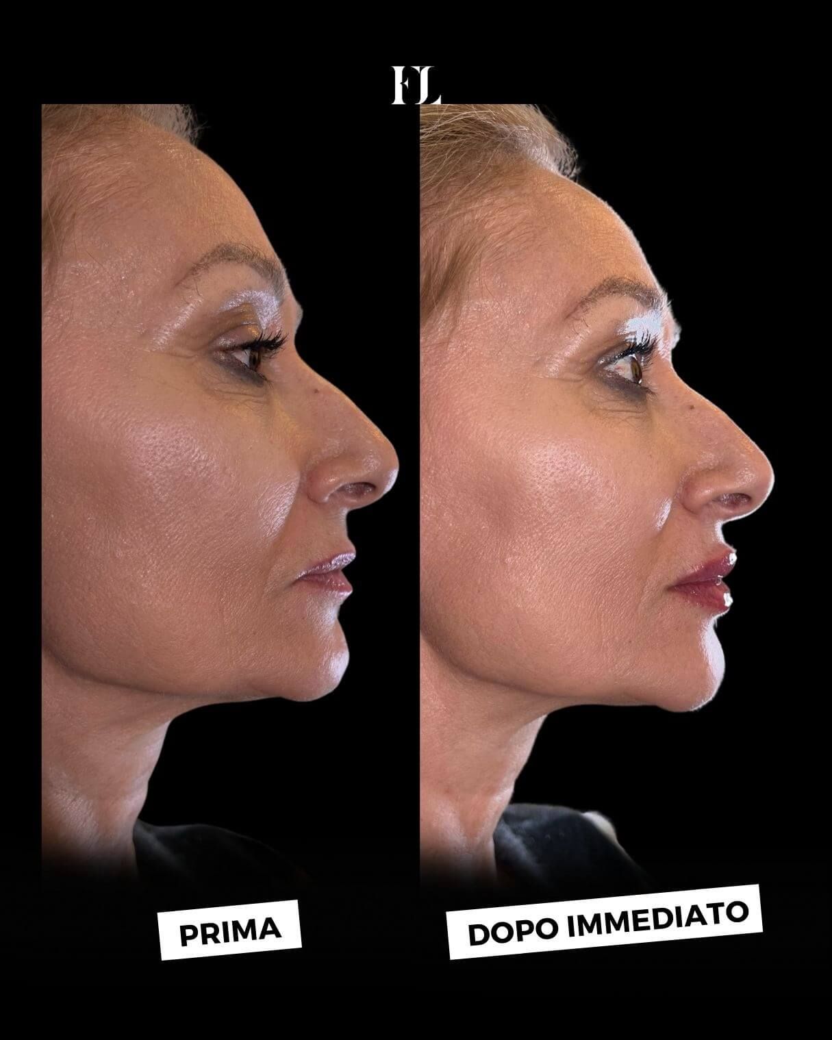 Floriana Lauritano-3