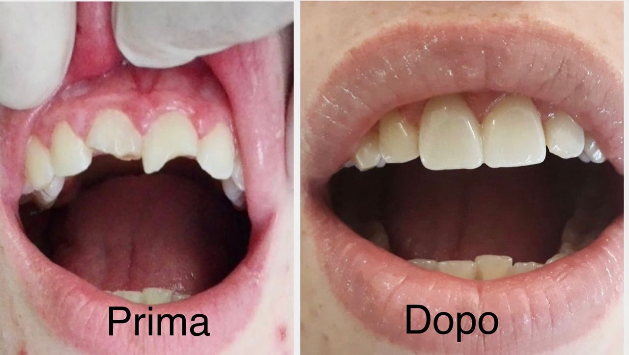 Federica Del Villano-2