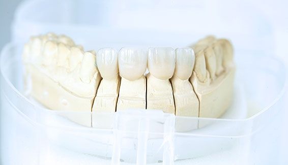 Dimitrios Papavasileiou-3