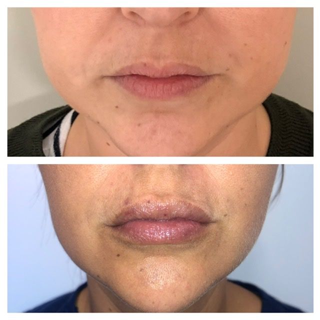 Víctor Hidalgo López-7