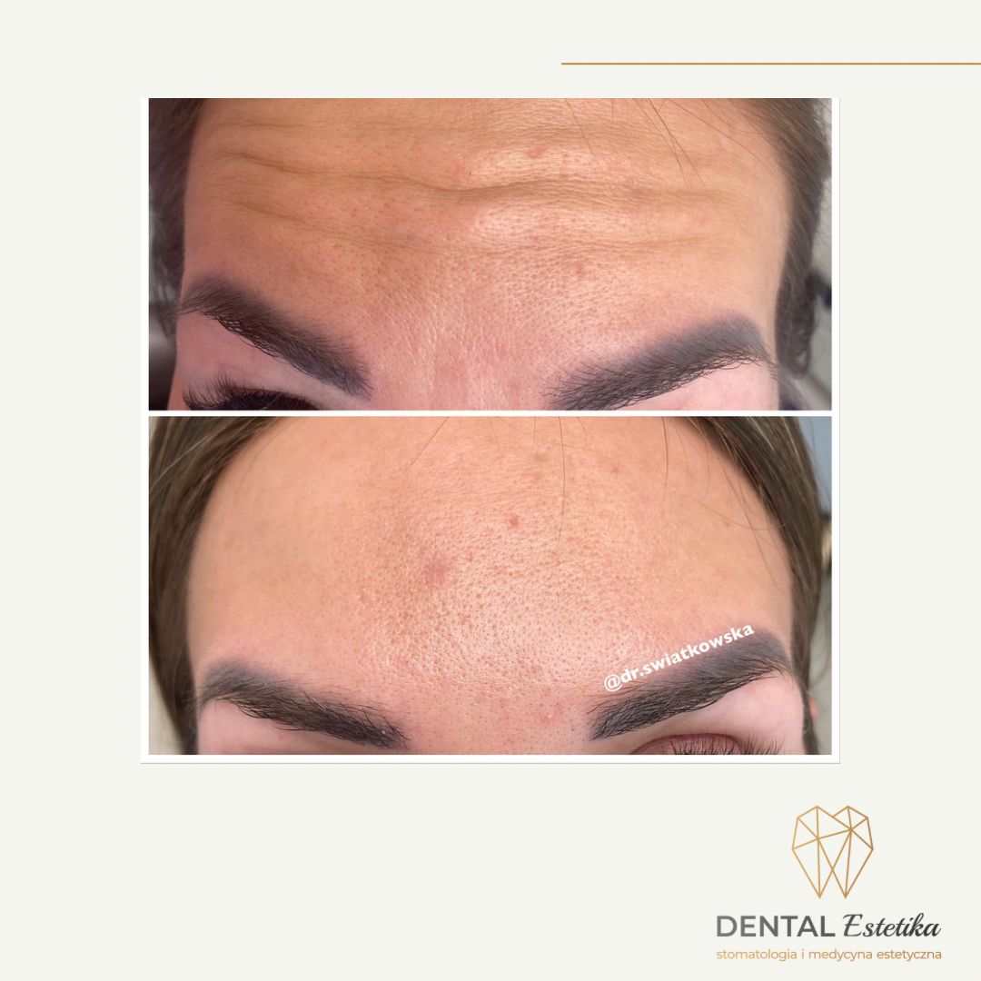 Angelika Świątkowska-23