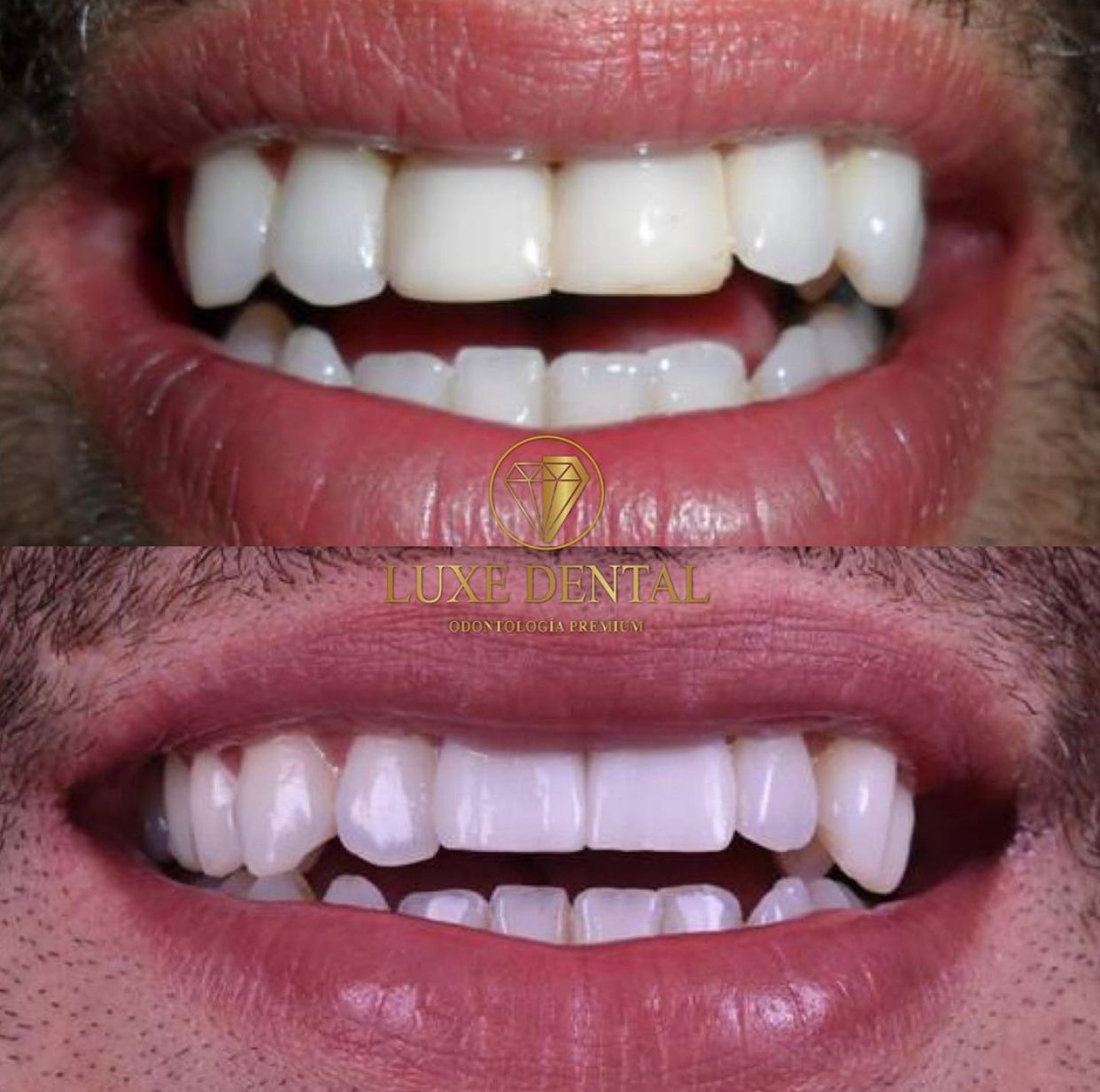 Ruben Patier Martin-4