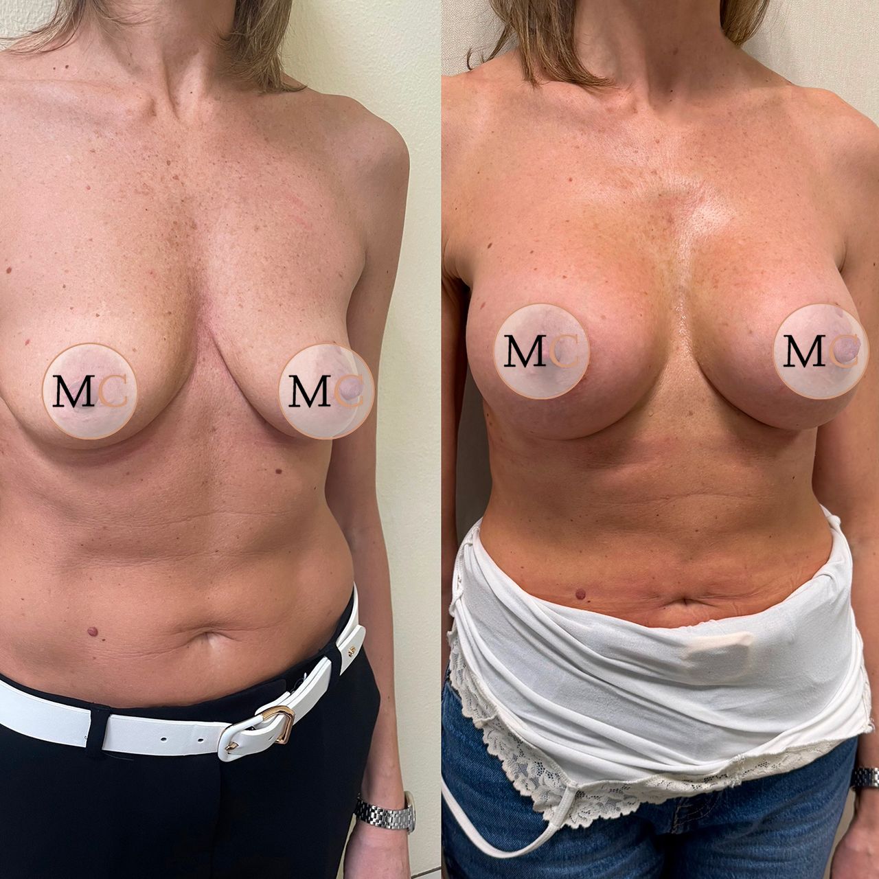 Marco Carmisciano-11