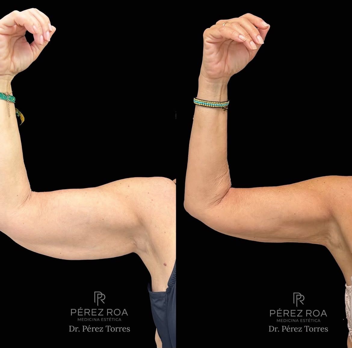 Francisco José Pérez Torres-7