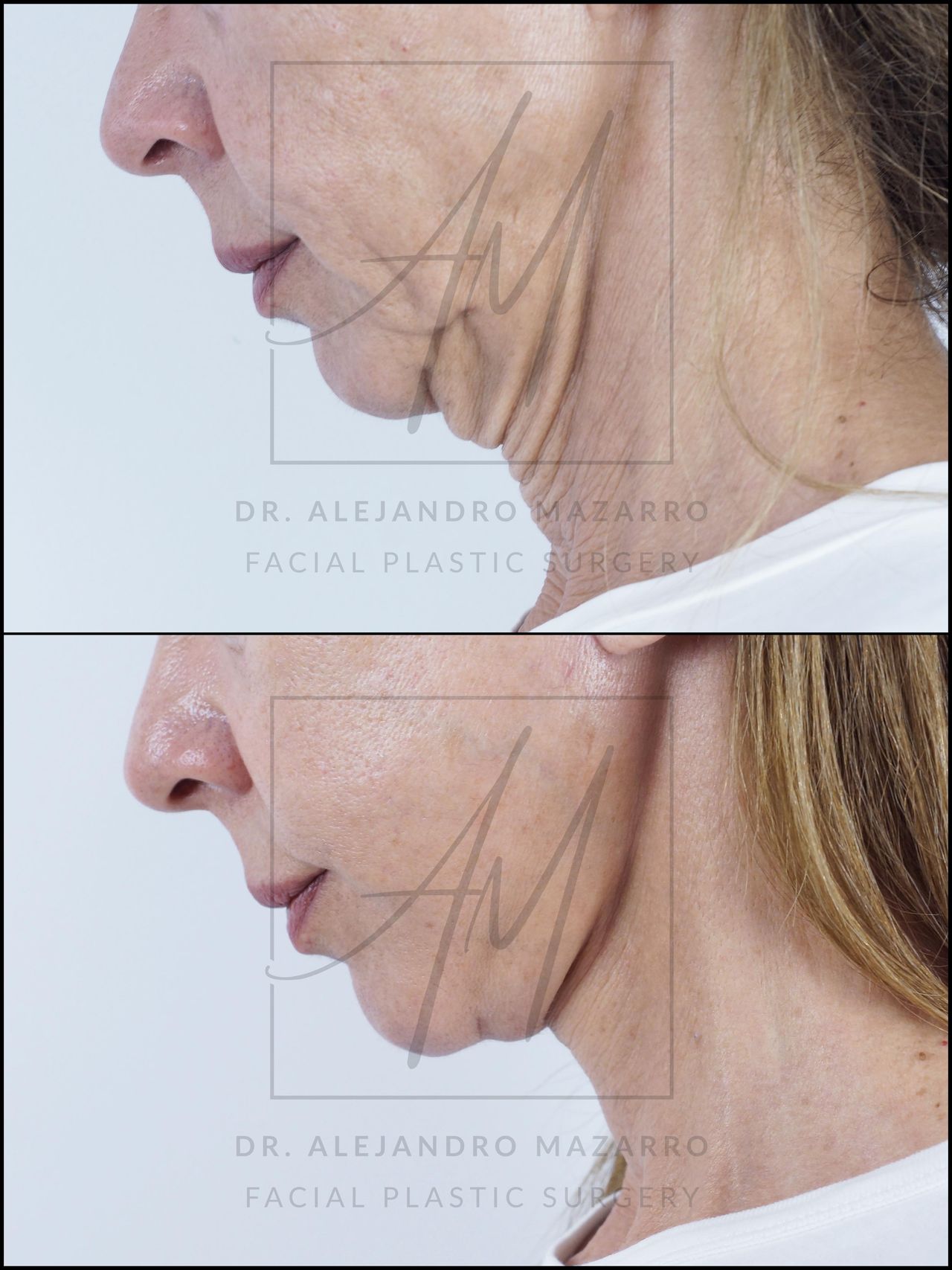 Alejandro Mazarro Campos-14