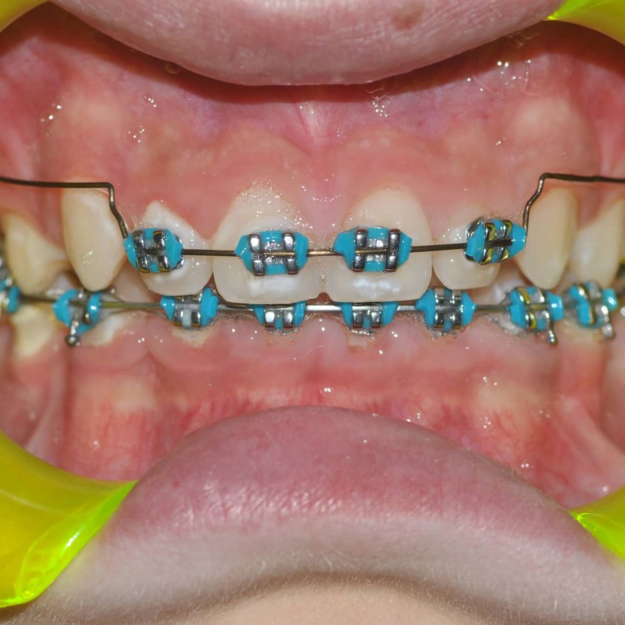 Gianluca Del Vecchio-92