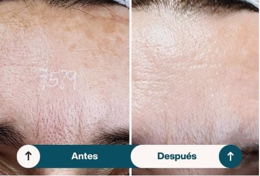 Nuna Quilla Pérez Alonso-1