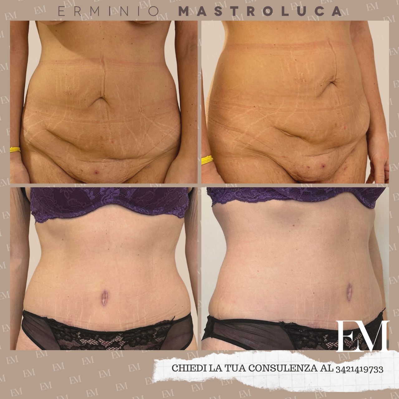 Erminio Mastroluca-19