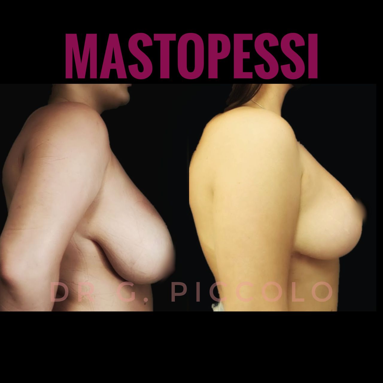 Giuseppina Piccolo-53