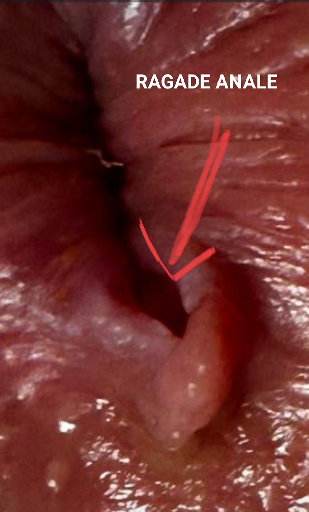 Francesco Rinaldi-27