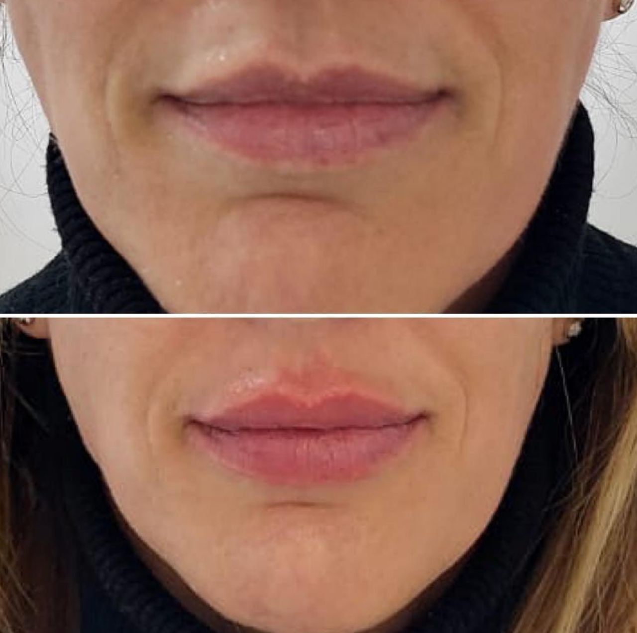 José Angel Molina Molero-1