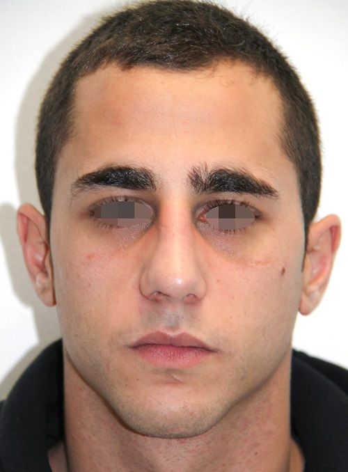 Xavier Barcelo Colomer-10