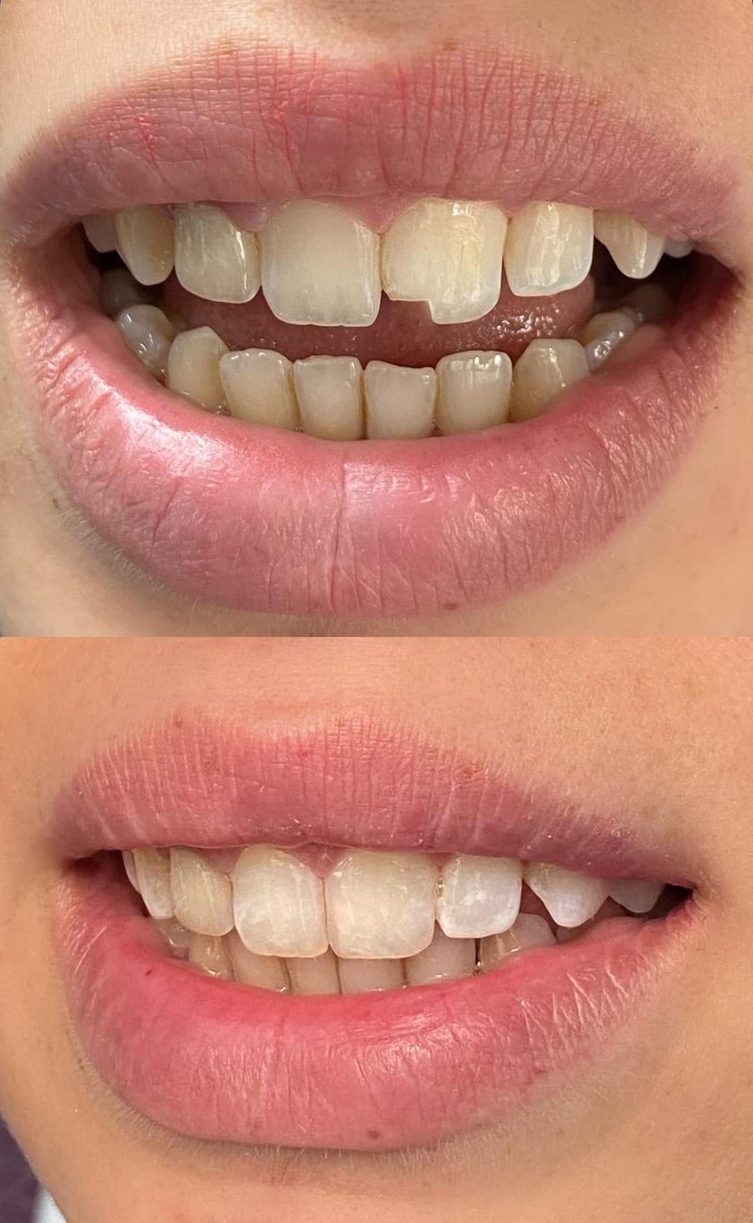 Vincenzo Santillo-12