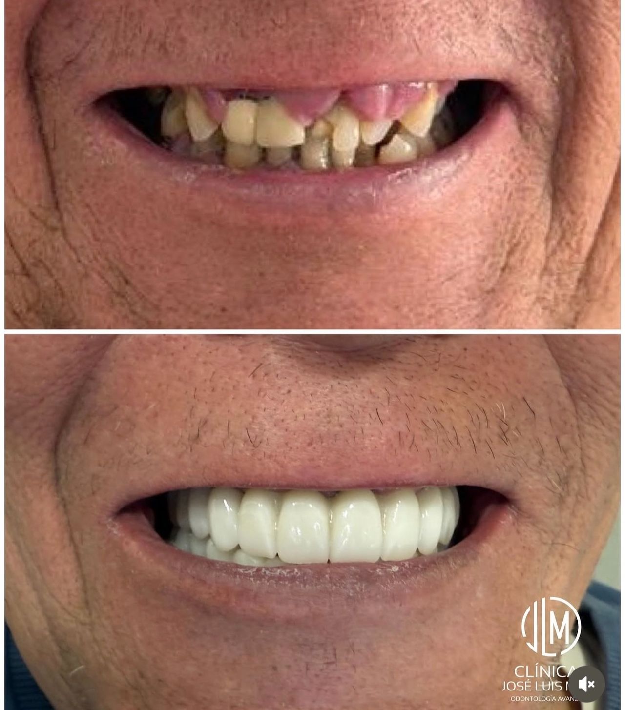 José Luis Mejía Martin-3