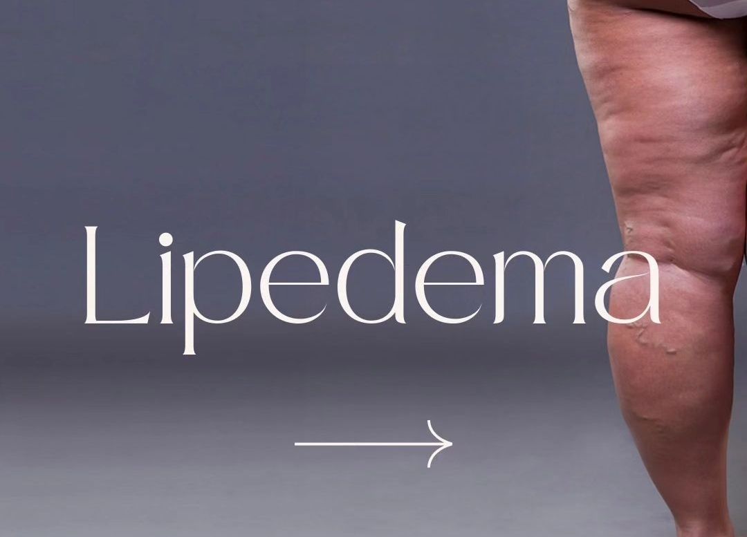 Francesca Intermite-51