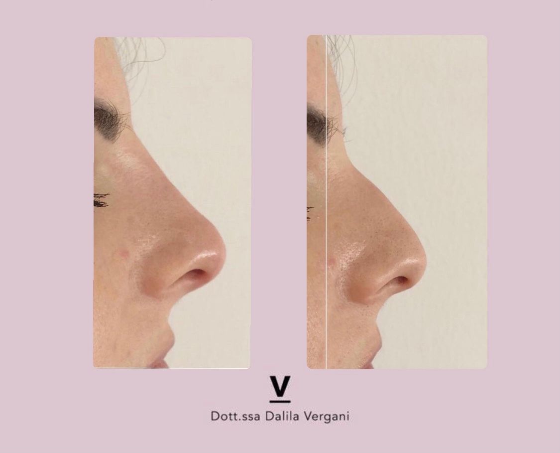 Dalila Vergani-45