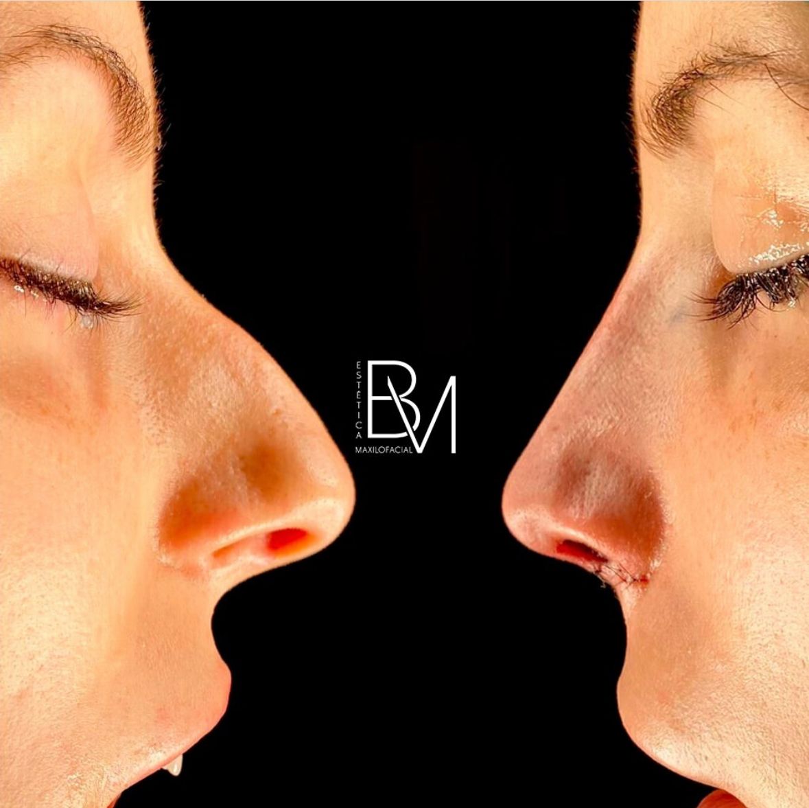 Beatriz Moralejo-19
