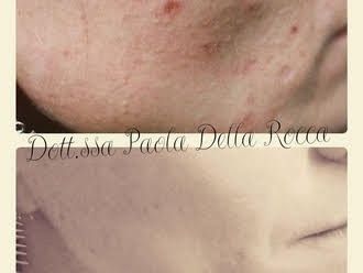 Paola Della Rocca-0