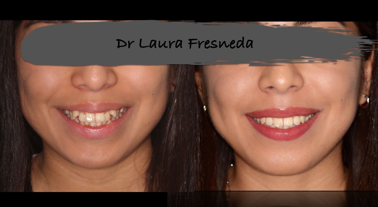 Laura Fresneda Bustos-18