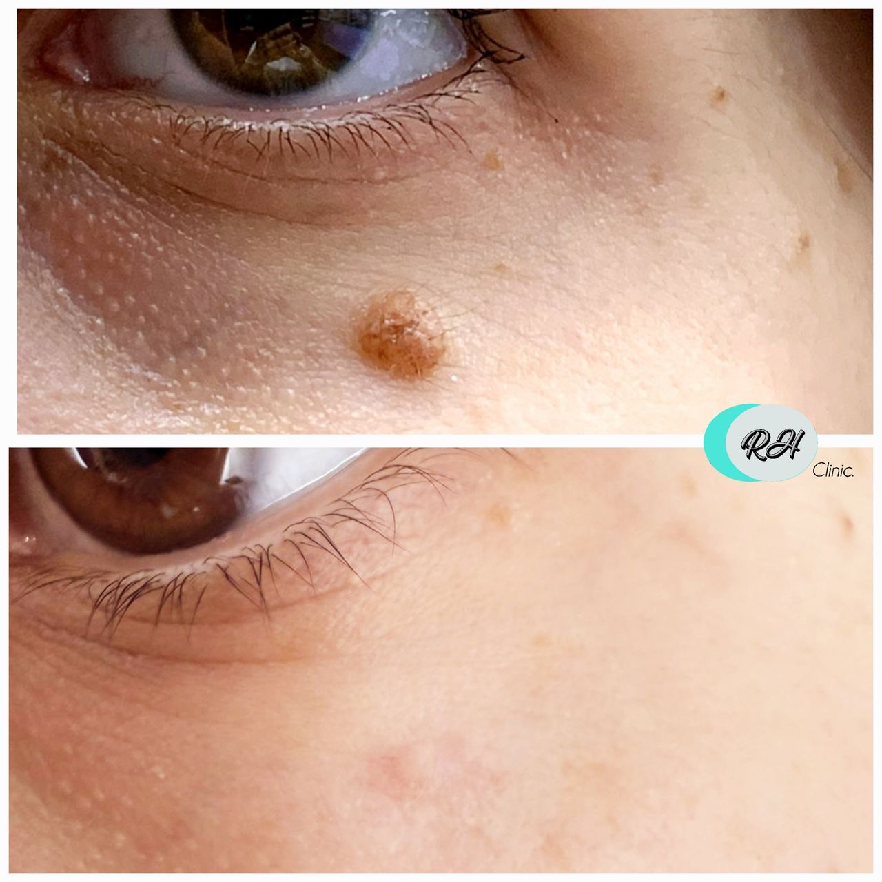 Rosalba Herrero Zerpa-620