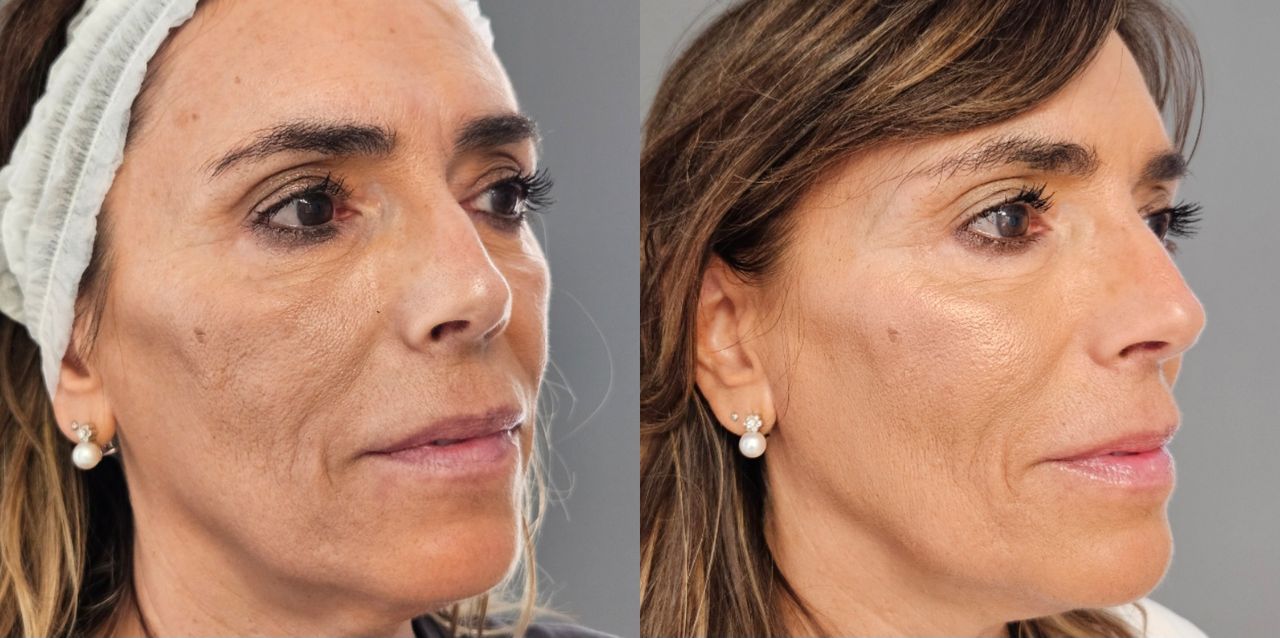 Rosalba Herrero Zerpa-450