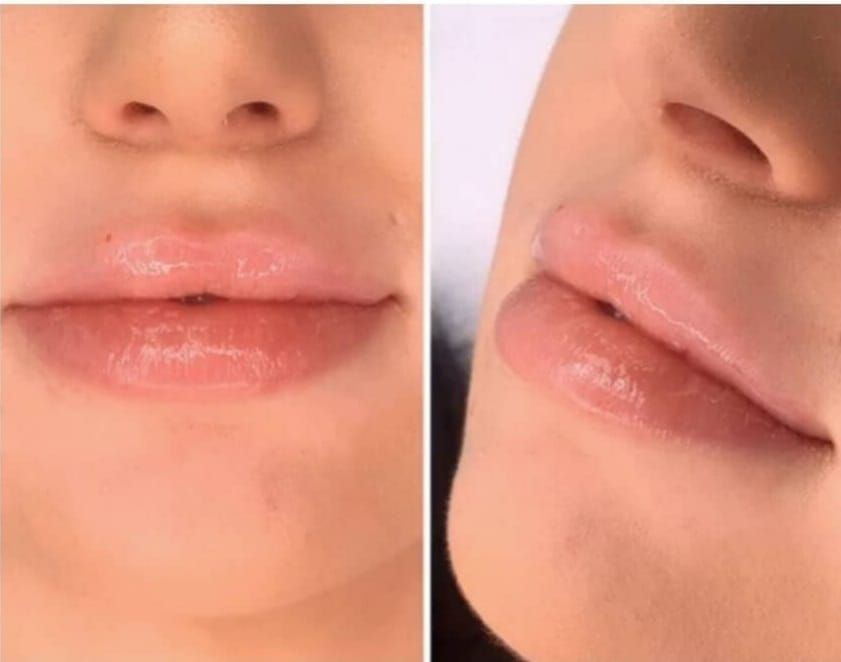 Lorella Di Battista-3