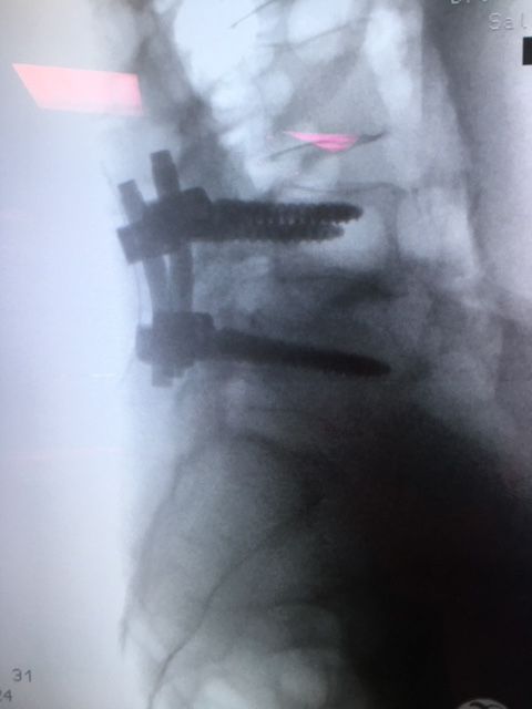 Massimo Brandolin-11