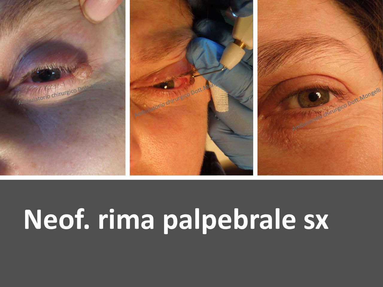 Matteo Antonio Mongelli-19