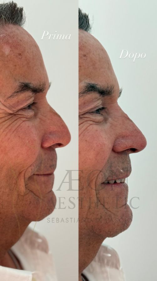 Sebastiano Di Lascio-7