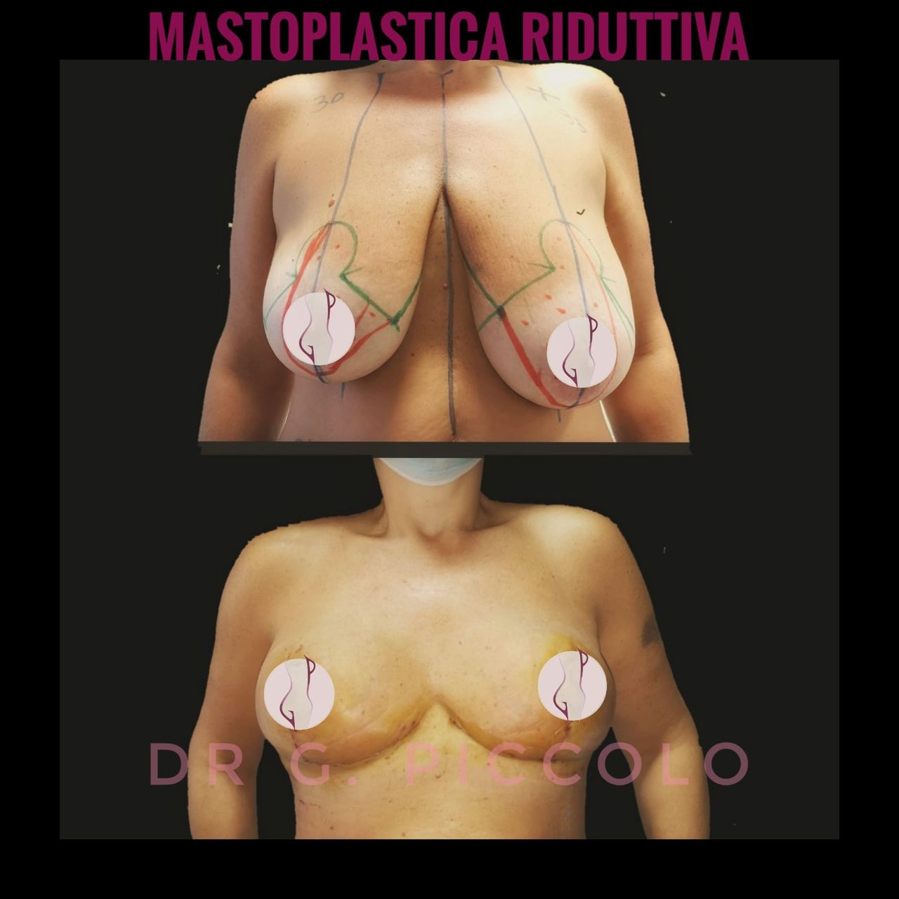 Giuseppina Piccolo-48