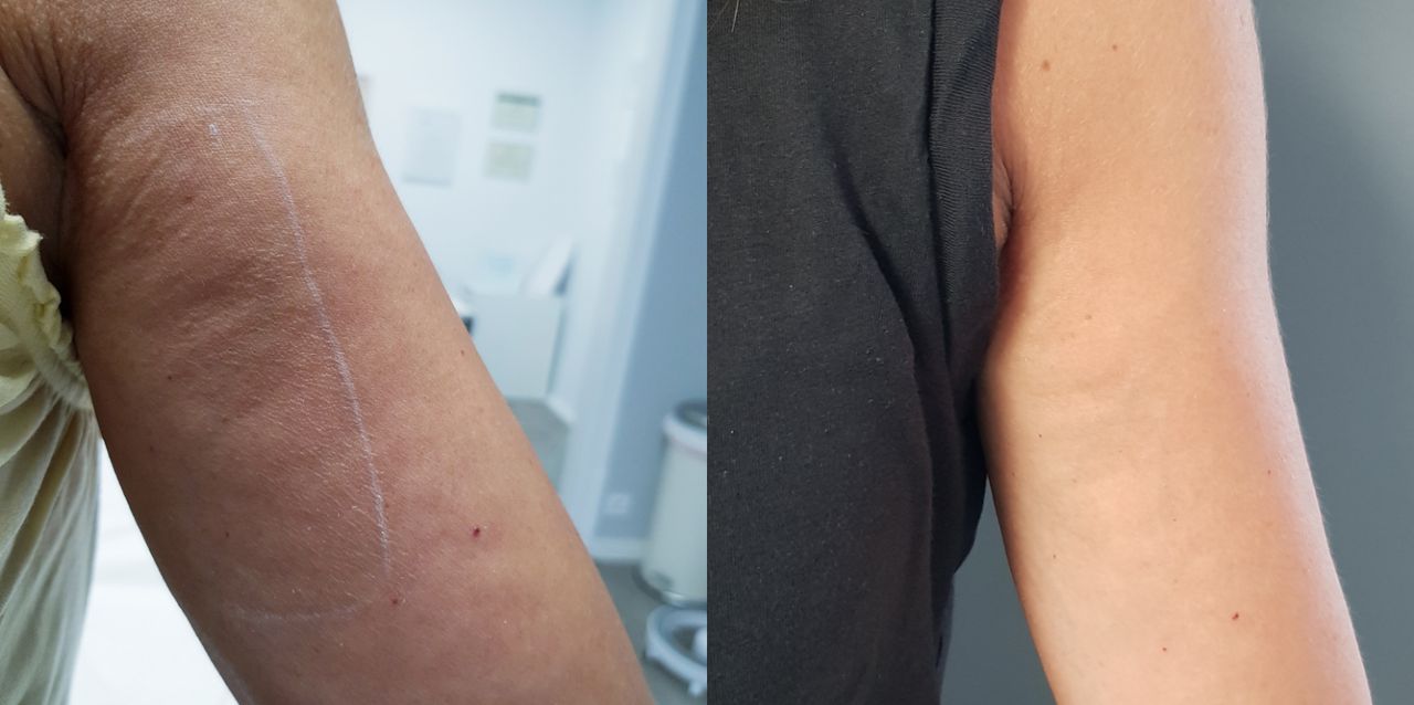 Rosalba Herrero Zerpa-171