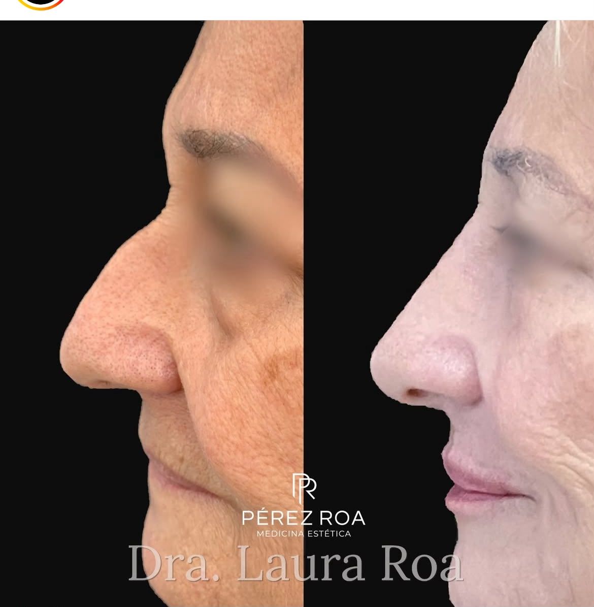 Laura Roa Fernandez-9