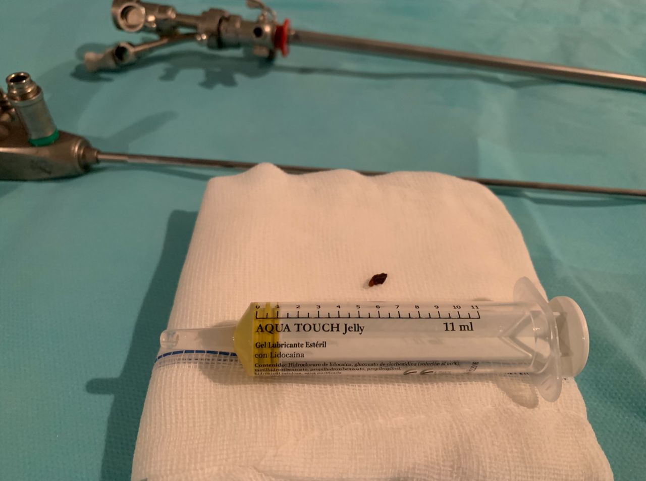 Luis Fernando Susaníbar Napurí-12