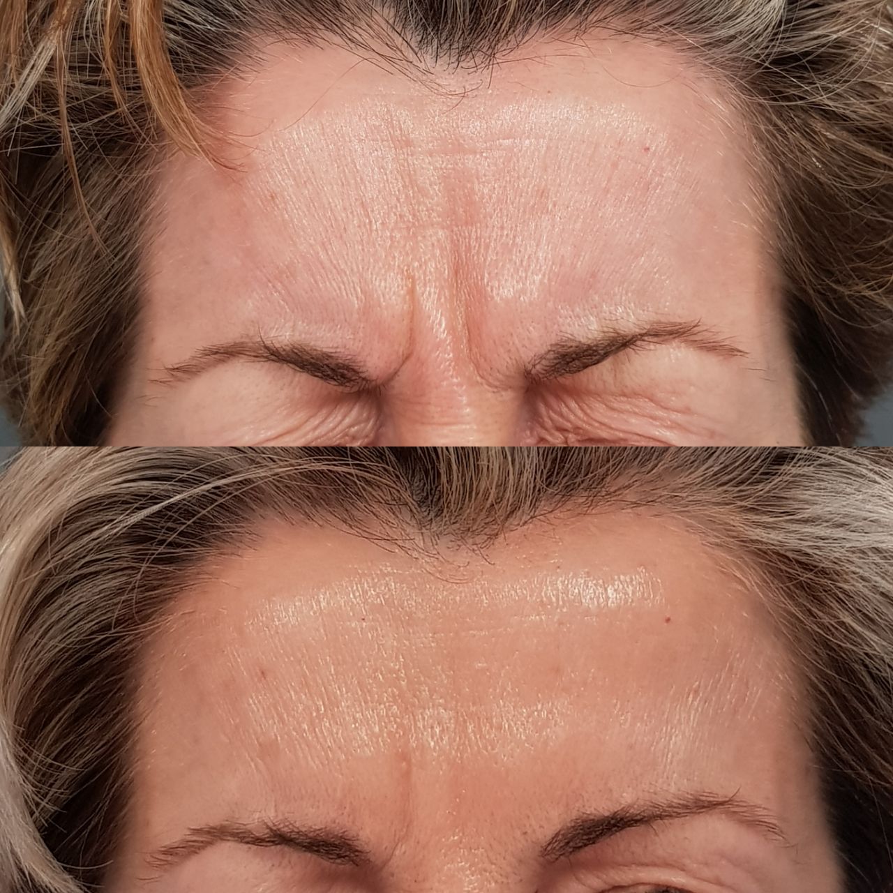 Rosalba Herrero Zerpa-201