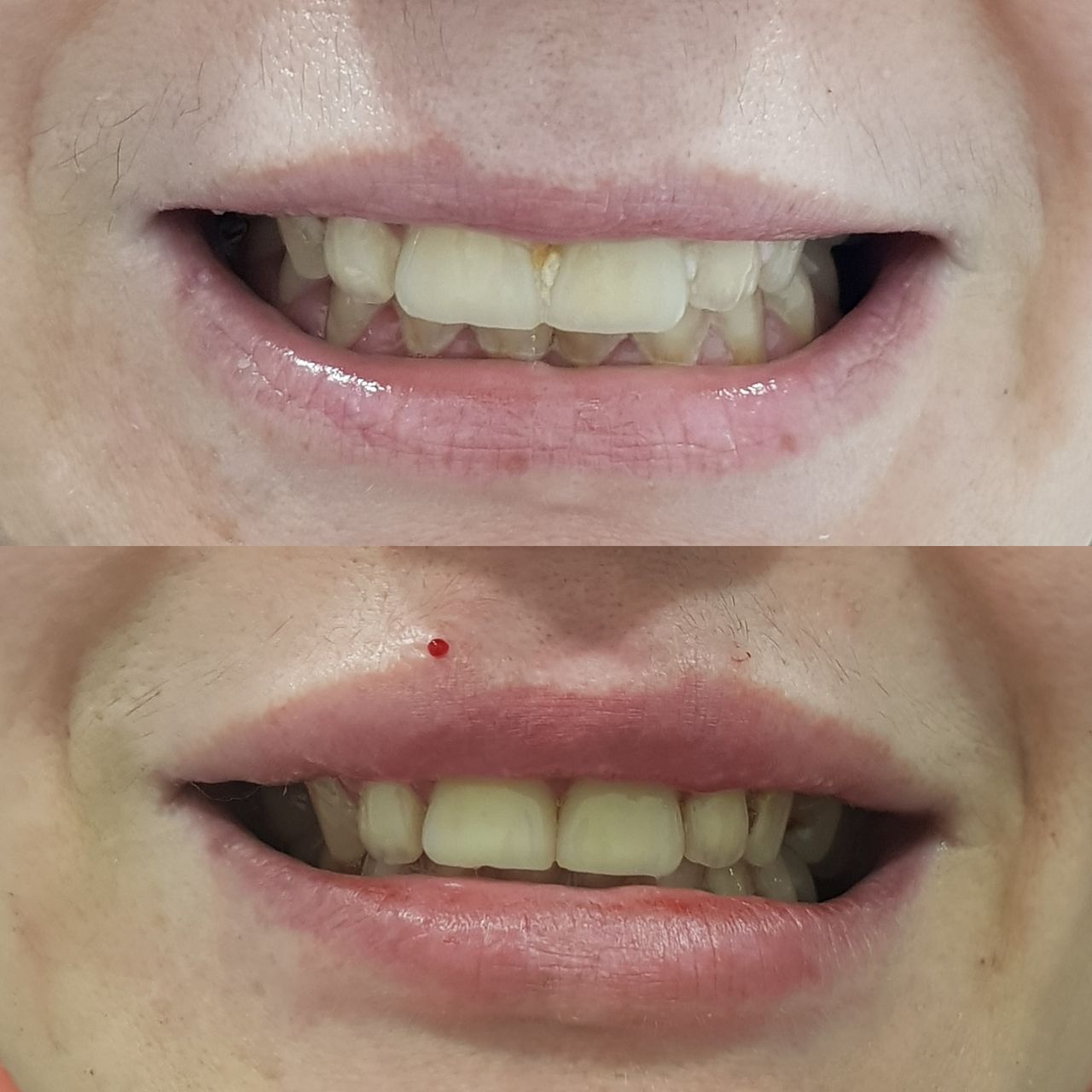 Rosalba Herrero Zerpa-238