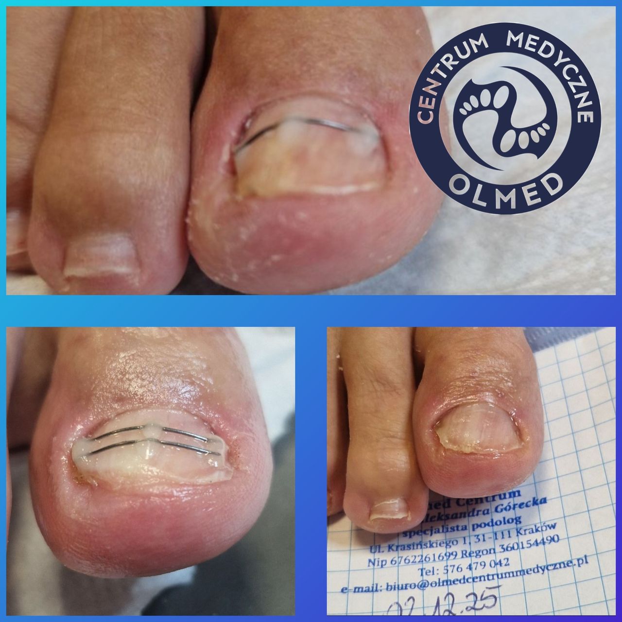 Aleksandra  Górecka -11