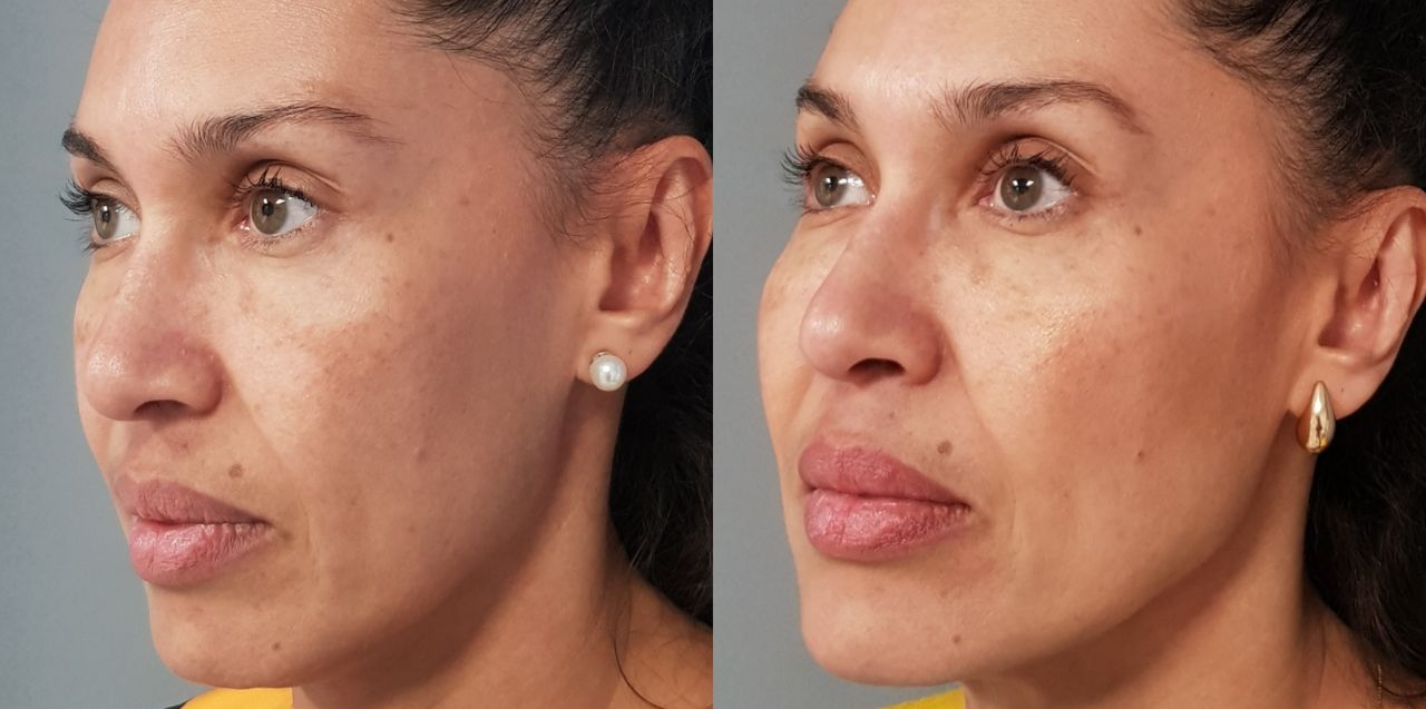 Rosalba Herrero Zerpa-479