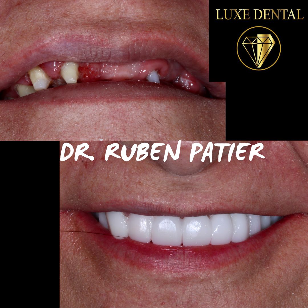 Ruben Patier Martin-25