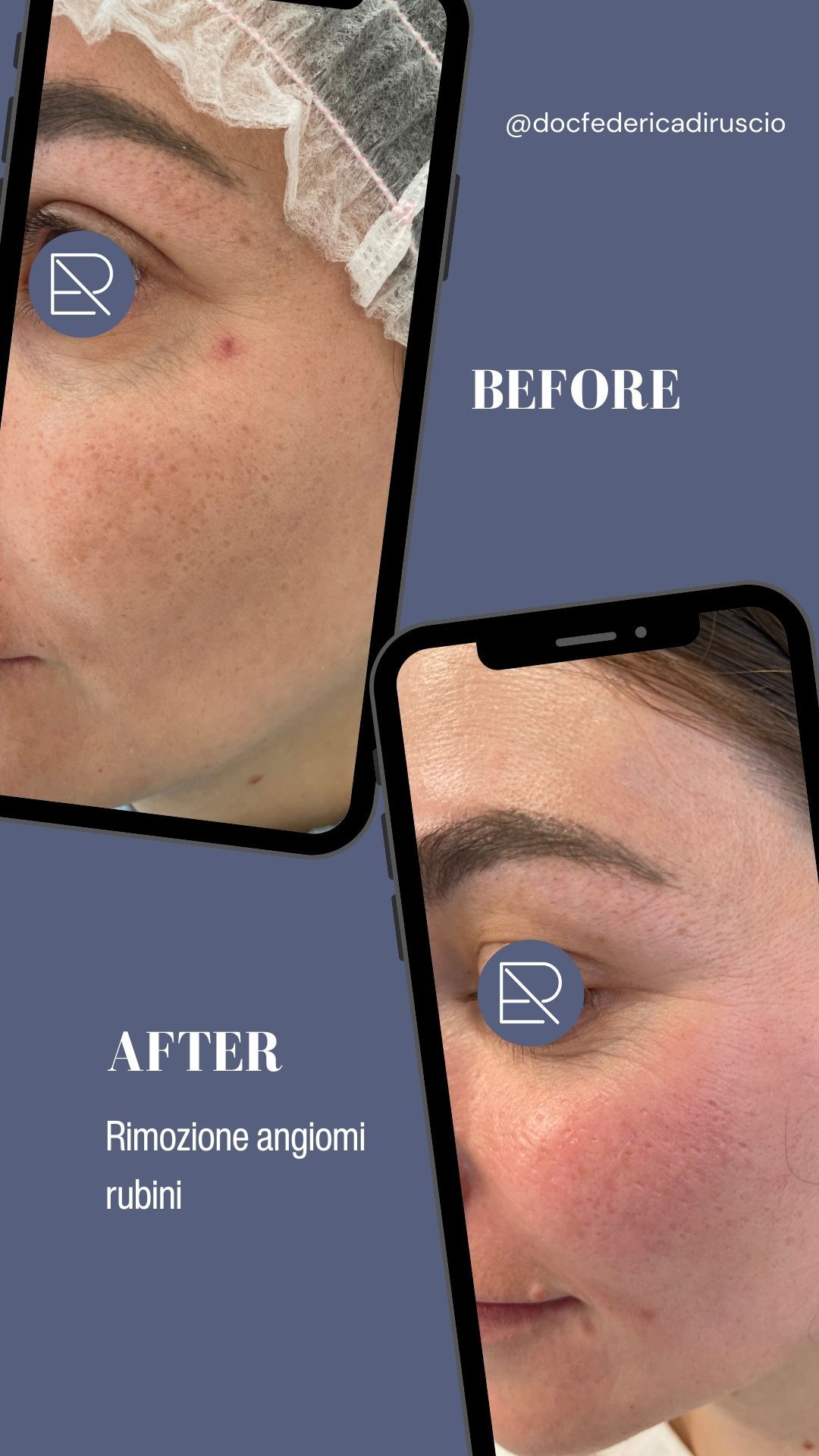 Federica Di Ruscio-4