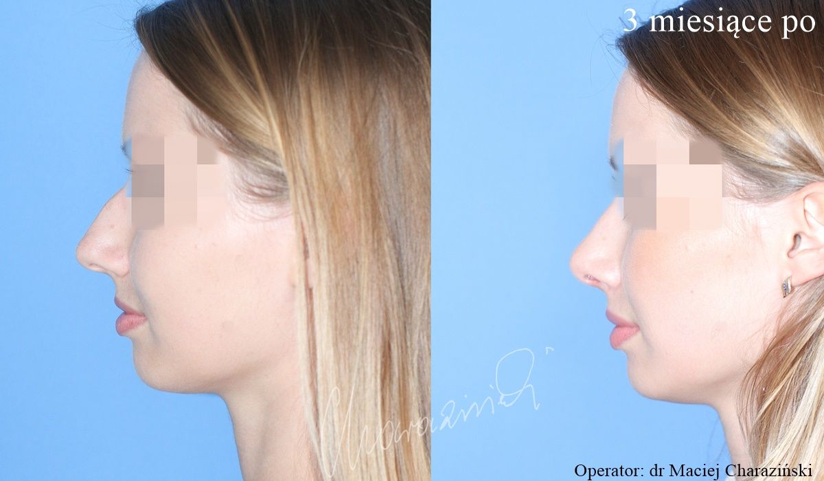 Maciej Charaziński-65