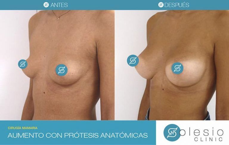 Francisco Solesio Pilarte-5