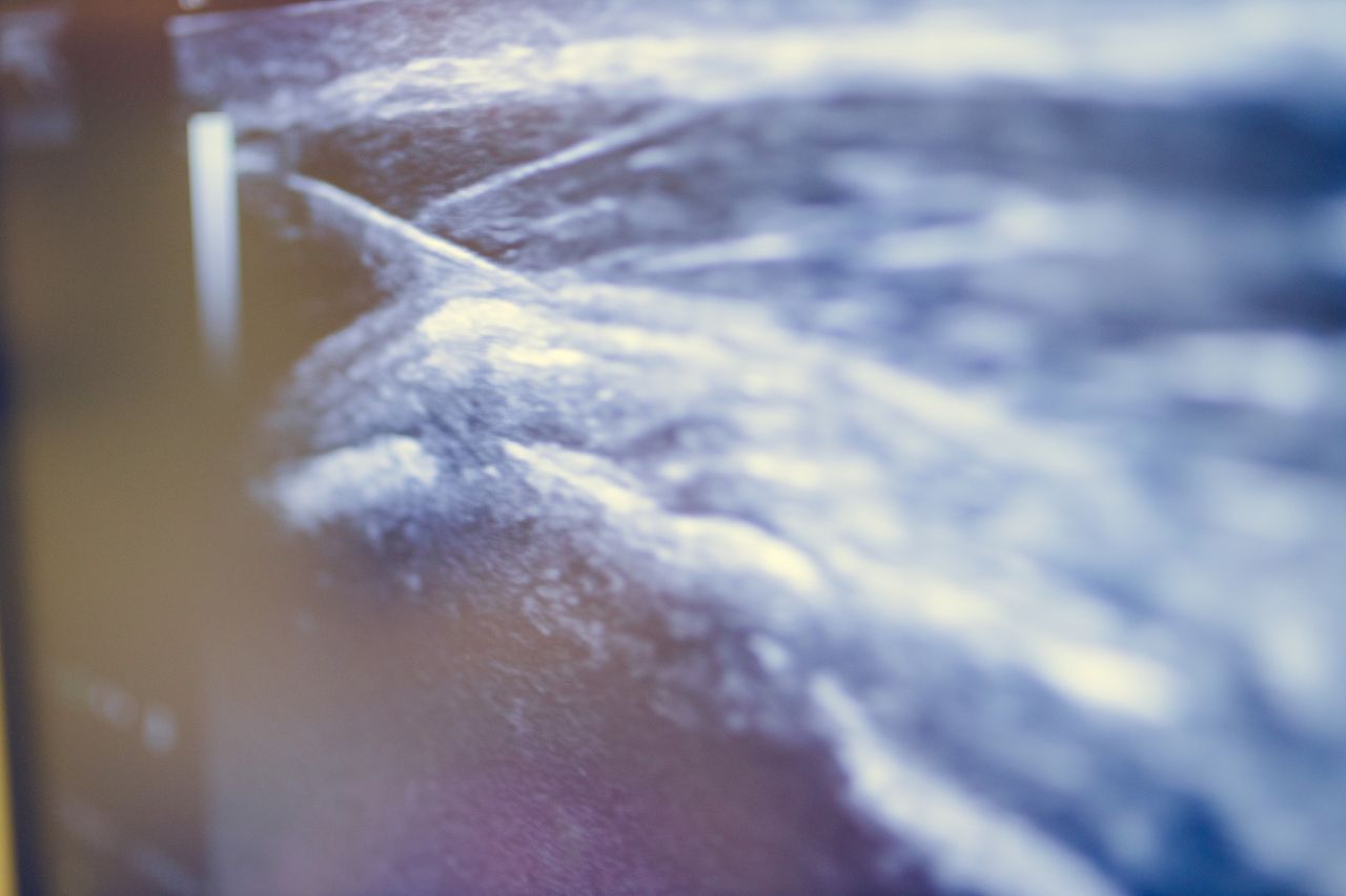 Victor Castro Valenzuela-12